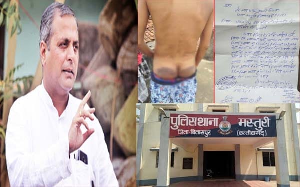 बिलासपुर पुलिस का अमानवीय चेहरा, पुलिस को बर्बरता से पिटाई करने का अधिकार नहीं : शैलेष पाण्डेय