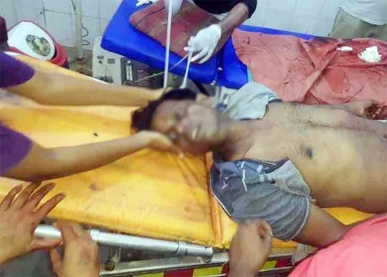 लवन में चाकूबाजी की घटना से एक युवक की मौत