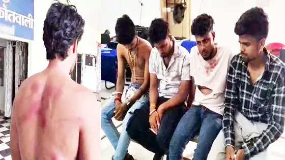 साले ने दोस्तों के साथ मिलकर अपने जीजा को कमरे में बंद कर बेरहमी से पीटा