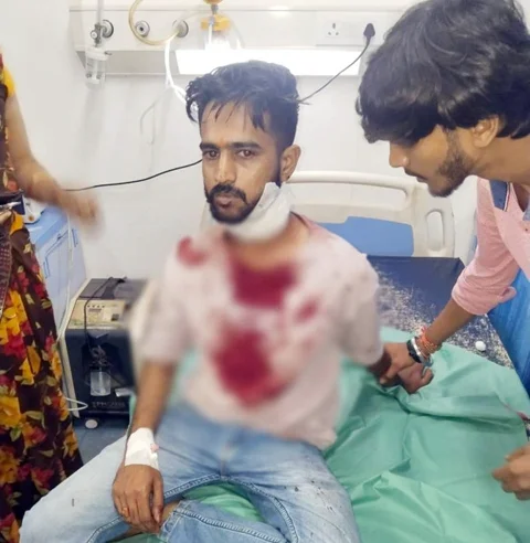 छेड़छाड़ रोकने पर युवक पर चाकू से जानलेवा हमला, आरोपी ने रेता गला
