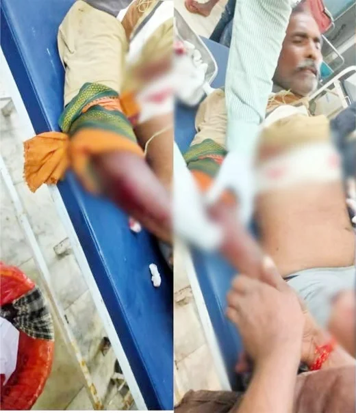 नकाबपोश युवकों ने कांग्रेस नेता के भाई को मारी गोली, हालत गंभीर, जांच में जुटी पुलिस …
