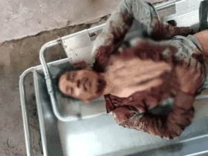 नाबालिग दोस्त के साथ मिलकर युवक को मार डाला