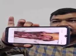 अस्पताल प्रबंधन की लापरवाही से गई मरीज़ की जान, परिजनों ने जताया आक्रोश