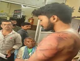 पुलिस ने युवको को गिरफ्तार कर बेरहमी से पीटा, तीनों जेल भेजे गए
