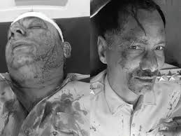 किडनैप पुलिसकर्मियों को छुड़ाने पहुंचे थानाधिकारी का सिर फोड़ा, 11 घायल-गाड़ियां भी तोड़ीं