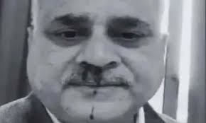 उप कुलपति पर डायरेक्टर ने किया प्राणघातक हमला, पीट-पीटकर किया लहूलुहान