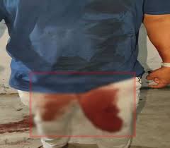 मामूली विवाद में युवक पर ताबड़तोड़ चाकू से वार, आरोपी फरार