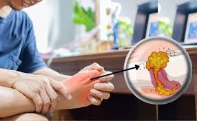 शरीर में जमा Uric Acid को बाहर निकाल फेंकेगे 6 ड्रिंक्स, किडनी की सफाई में भी हैं मददगार