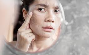 घरेलू नुस्खों से पाएं बेदाग त्वचा: दाग-धब्बों को हटाने के आसान उपाय