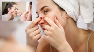 पिंपल्स और ऑयली स्किन से छुटकारा पाने के आसान और असरदार तरीके