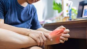 यूरिक एसिड 7 दिन में कम कर सकते हैं ये घरेलू तरीके! तुरंत देते हैं आराम